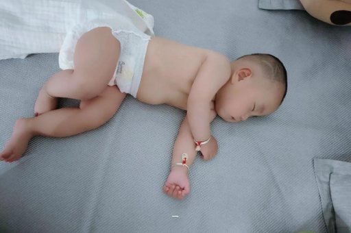 上海宝宝脸上有白色斑块 上海宝宝脸上有白色斑块